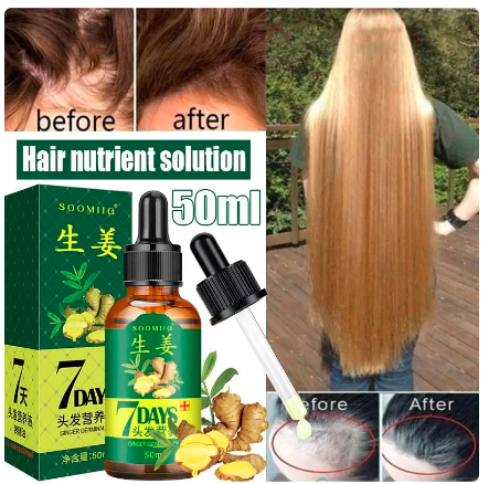 Ginger Hair Growth Spray Serum For Anti Hair Loss Essential Oil Products Fast Treatment Prevent Hair Thinning Dry Frizzy Repair - Amado Deals - wholesale and distributors with free shipping in United States Ginger Hair Growth Spray Serum For Anti Hair Loss Essential Oil Products Fast Treatment Prevent Hair Thinning Dry Frizzy Repair - Amado Deals - wholesale and distributors with free shipping in United States